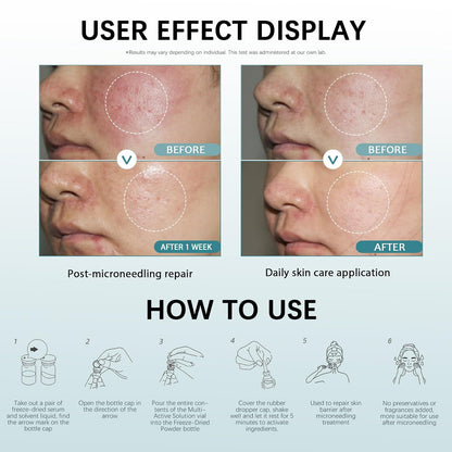 Post Microneedling Serum, After Microneedling Care, Tremella Extract+Freeze-Dried Hydrolyzed Collagen Serum, All Preservatives-Free, Instant Deep Hydration Smoothing, Soothing for Sensitive Skin(25ml)