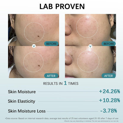 Post Microneedling Serum, After Microneedling Care, Tremella Extract+Freeze-Dried Hydrolyzed Collagen Serum, All Preservatives-Free, Instant Deep Hydration Smoothing, Soothing for Sensitive Skin(25ml)