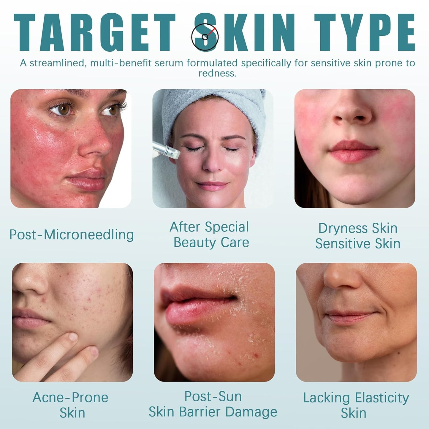 Post Microneedling Serum, After Microneedling Care, Tremella Extract+Freeze-Dried Hydrolyzed Collagen Serum, All Preservatives-Free, Instant Deep Hydration Smoothing, Soothing for Sensitive Skin(25ml)