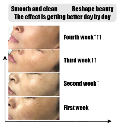 3pcs/lot 400ml AS1 SA2 AO3 Hydra Facial Serum Set Aqua Peeling Solution For Hydra facial Machine Deep Cleaning Face Skincare